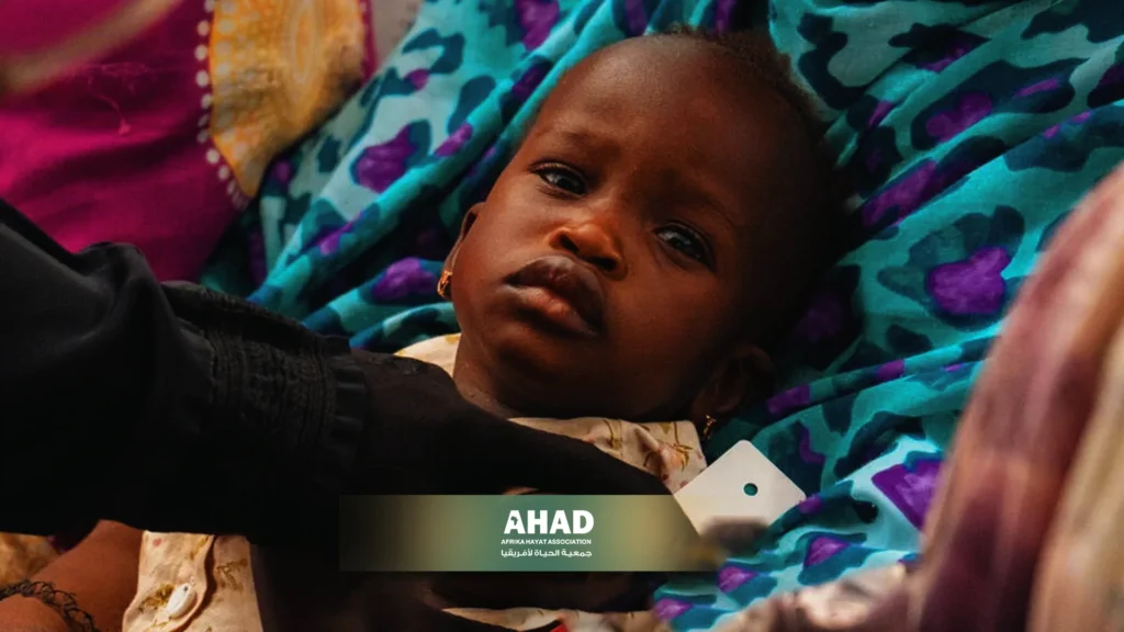 Sudanese Children and Acute Malnutrition