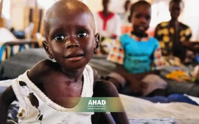 Sudanese Children and Acute Malnutrition