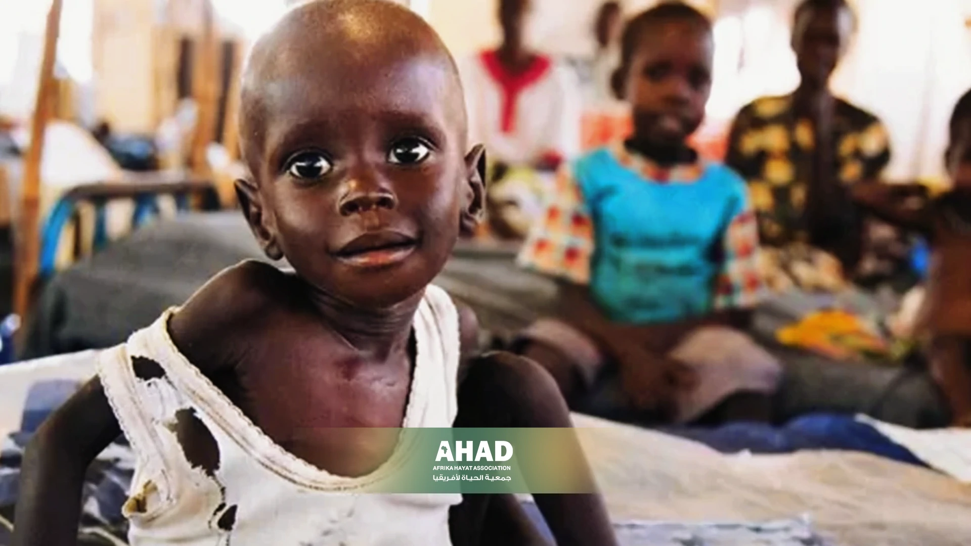 Sudanese Children and Acute Malnutrition