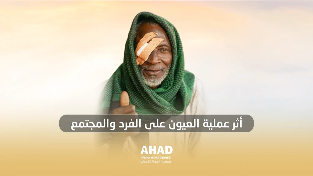 التبرع لعمليات العيون صدقة جارية في أفريقيا